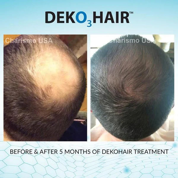 DEKOHAIR kaufen in Deutschland