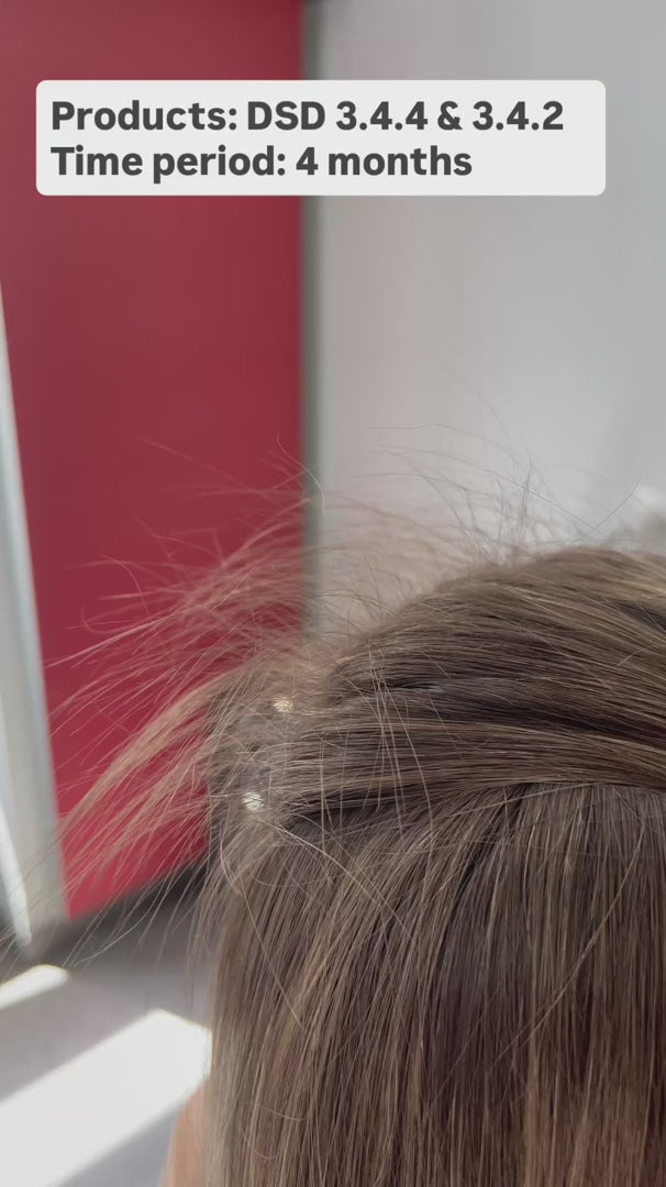 Echte Ergebnisse – 4 Monate (Video)